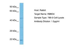 RBM34 Rabbit anti-Human, Polyclonal, Novus Biologicals 0.1ml; Unconjugated:Antibodies,